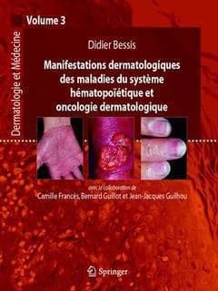 Dermatologie et médecine Tome 3 ; manifestations dermatologiques des maladies du système hématopoiétique et oncologie, dermatologique