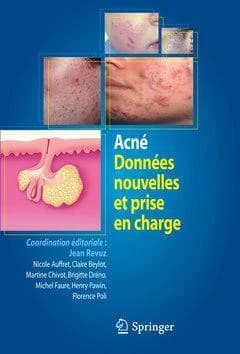 Acné : données nouvelles et prise en charge