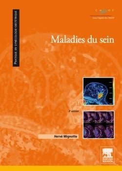 Maladies du sein (2e édition) Hervé Mignotte ; dessins Carole Fumat