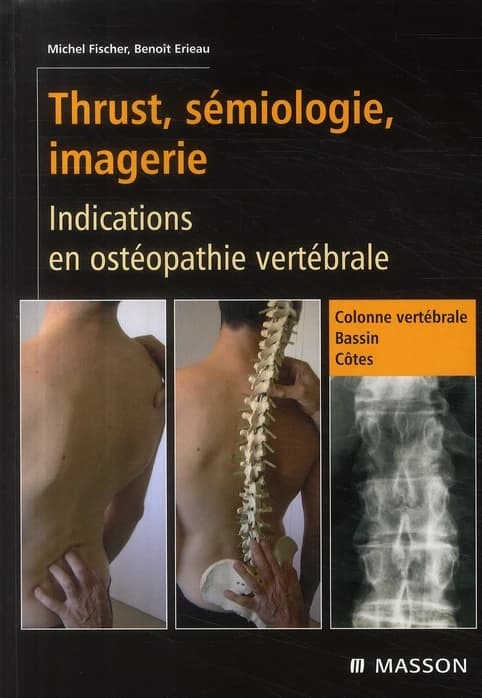 Thrust, sémiologie, imagerie : indications en ostéopathie vertébrale : synthèse des tests et des normalisations structurelles avec thrust Bassin-Colonne vértébrale-Côtes