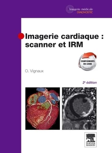 Imagerie cardiaque : scanner et IRM (2e édition) [edité] par Olivier Vignaux