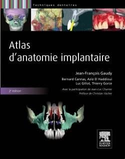 Atlas d'anatomie implantaire (2e éd.) Jean-François Gaudy [and others]