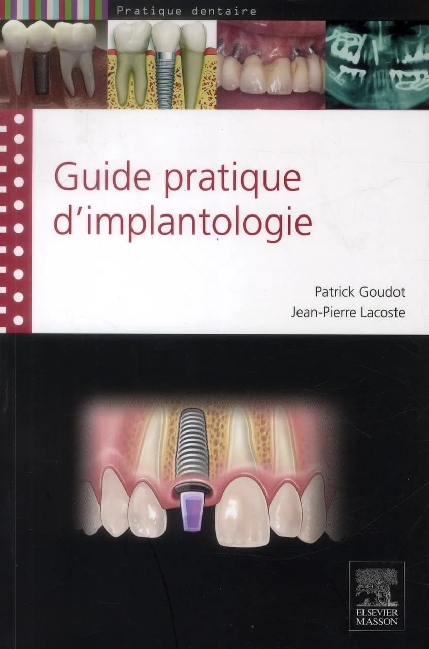 Guide pratique d'implantologie