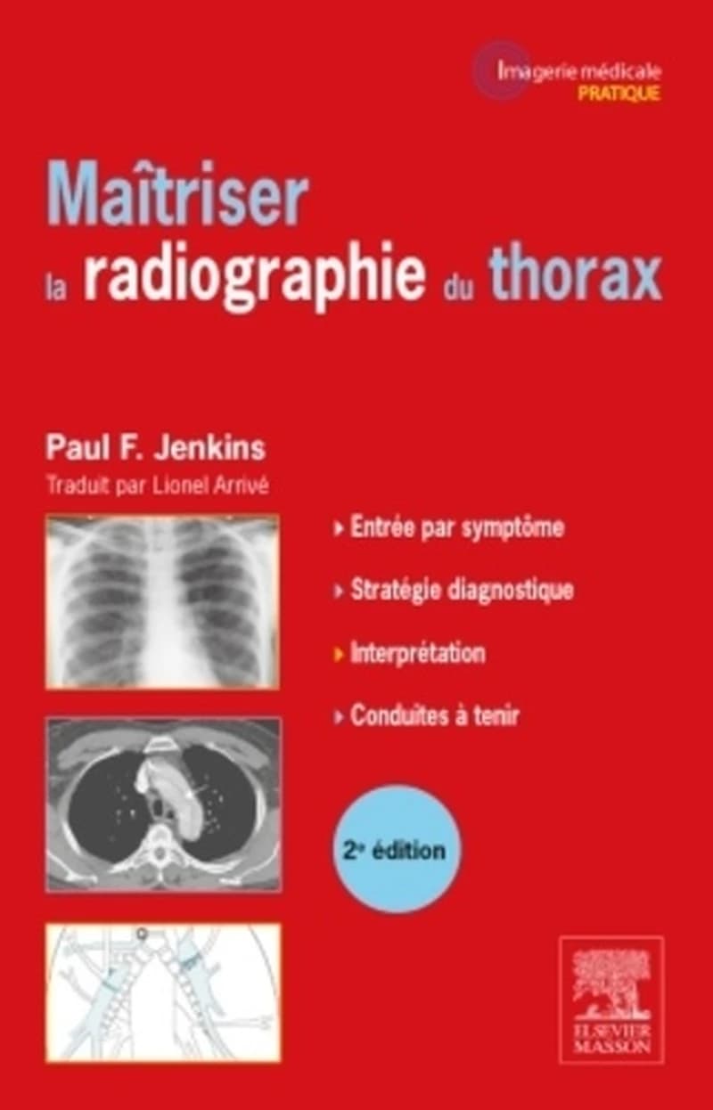 Maîtriser la radiographie du thorax : guide pratique (2e éd.) Paul F. Jenkins,... ; traduction de l'anglais, Lionel Arrivé,...