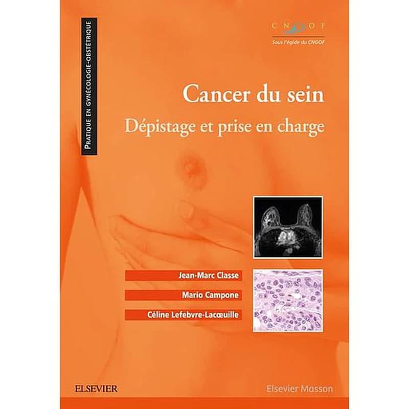 Cancer du sein : dépistage et prise en charge