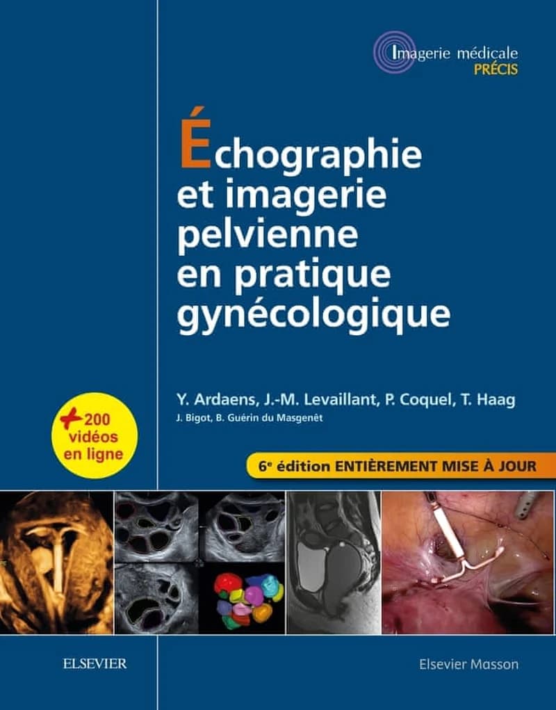 Échographie et imagerie pelvienne en pratique gynécologique (6e éd.) Yves Ardaens, Jean-Marc Levaillant, Philippe Coquel... [et al.] ; préface de Denis Querleu ; dessins de Carole Fumat