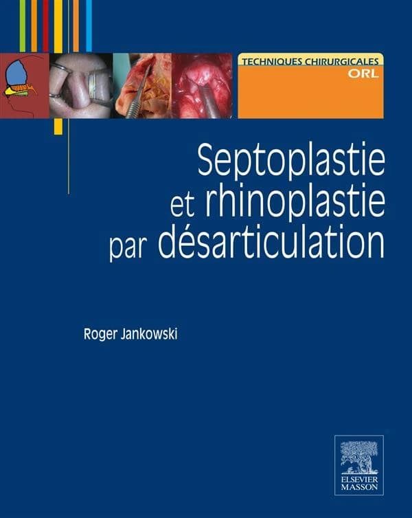 Septoplastie et rhinoplastie par désarticulation : histoire, anatomie, chirurgie et architecture naturelles du nez