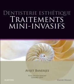 Traitements mini-invasifs : dentisterie esthétique
