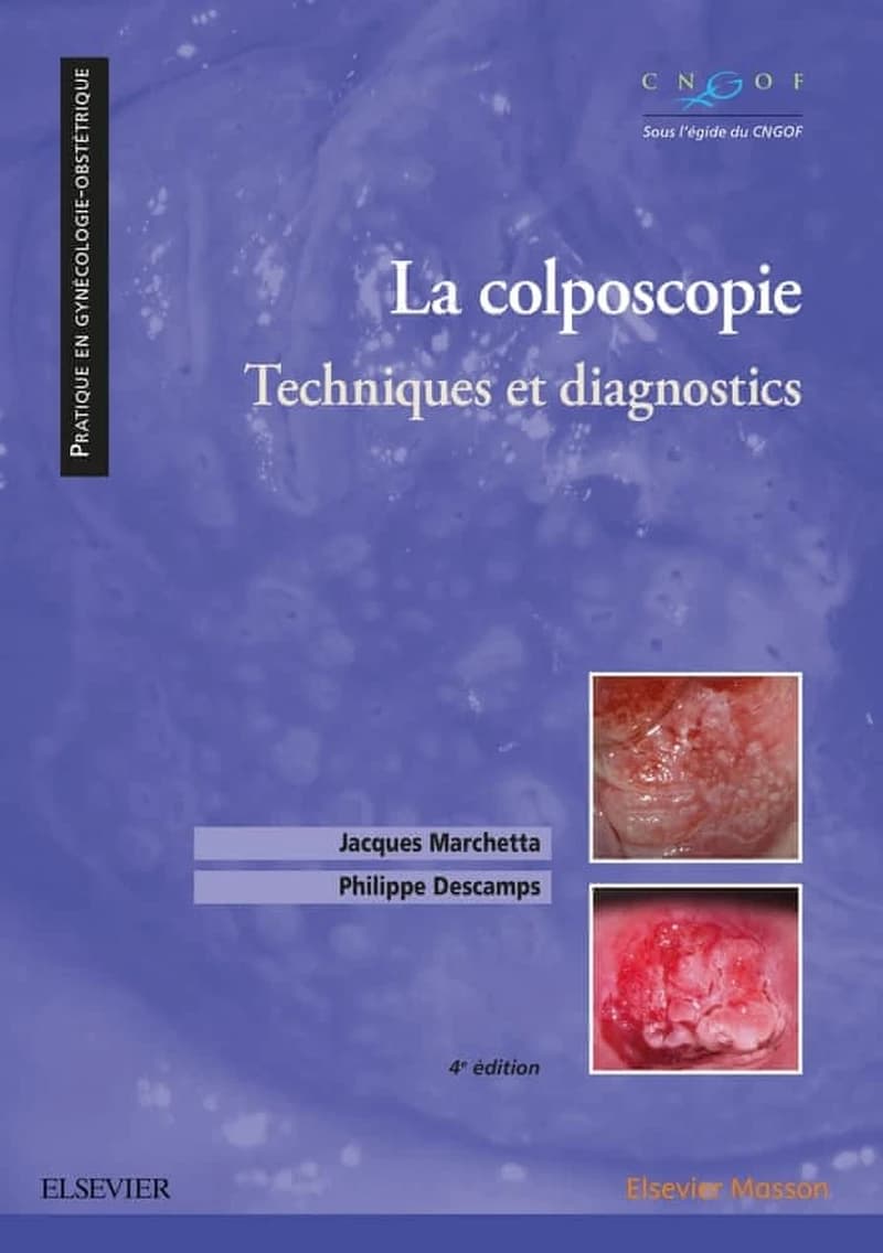 La colposcopie : technique et diagnostics (4e éd.) Jacques Marchetta, Philippe Descamps ; avec la collaboration de J.-J. Baldauf, Ch. Bergeron, J.-P. Bilhaut... [et al.] ; sous l'égide du Collège national des gynécologues et obstréticiens français, CNGOF.