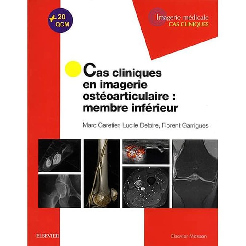 Cas cliniques en imagerie ostéoarticulaire : membre inférieur