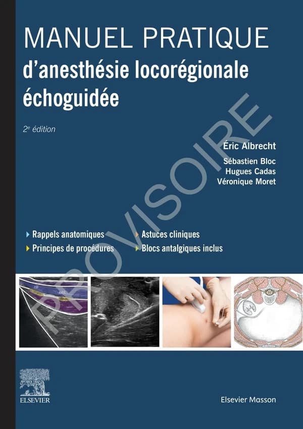 Manuel pratique d'anesthésie locorégionale échoguidée (2e éd.) Éric Albrecht,... Sébastien Bloc,... Hugues Cadas,... [et al.]