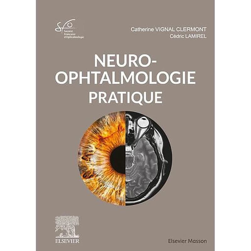Neuro-ophtalmologie pratique : rapport 2020