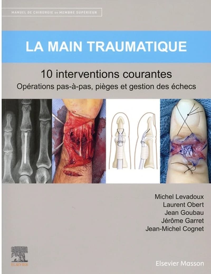 La main traumatique : 10 interventions courantes