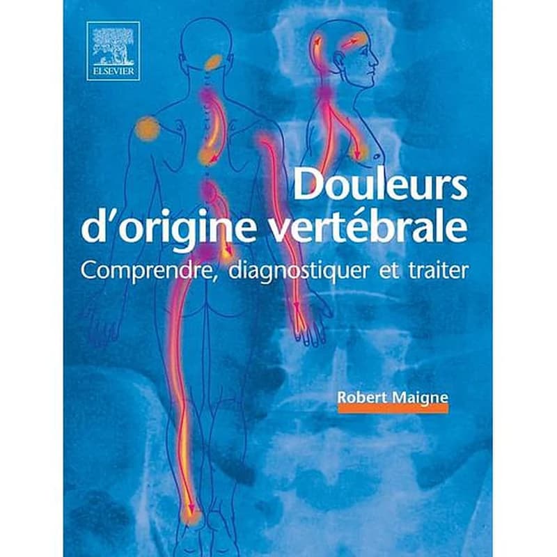 Douleurs d'origine vertébrale : comprendre, diagnostiquer et traiter