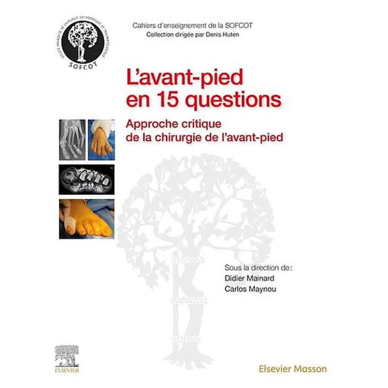 L'avant-pied en 15 questions : approche critique de la chirurgie de l'avant-pied