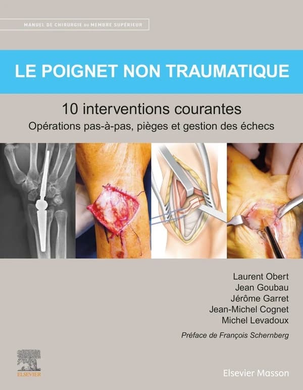 Le poignet non traumatique : 10 interventions courantes