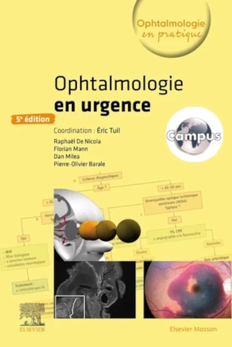 CAMPUS  OPHTALMOLOGIE EN URGENCE
