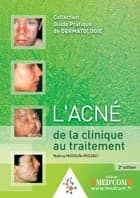 Acné : de la clinique au traitement (2e éd.) Dr Naïma Midoun-Mouaci,...