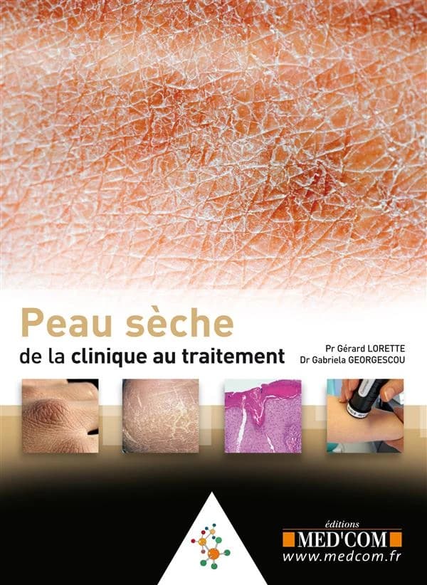 Peau sèche : de la clinique au traitement