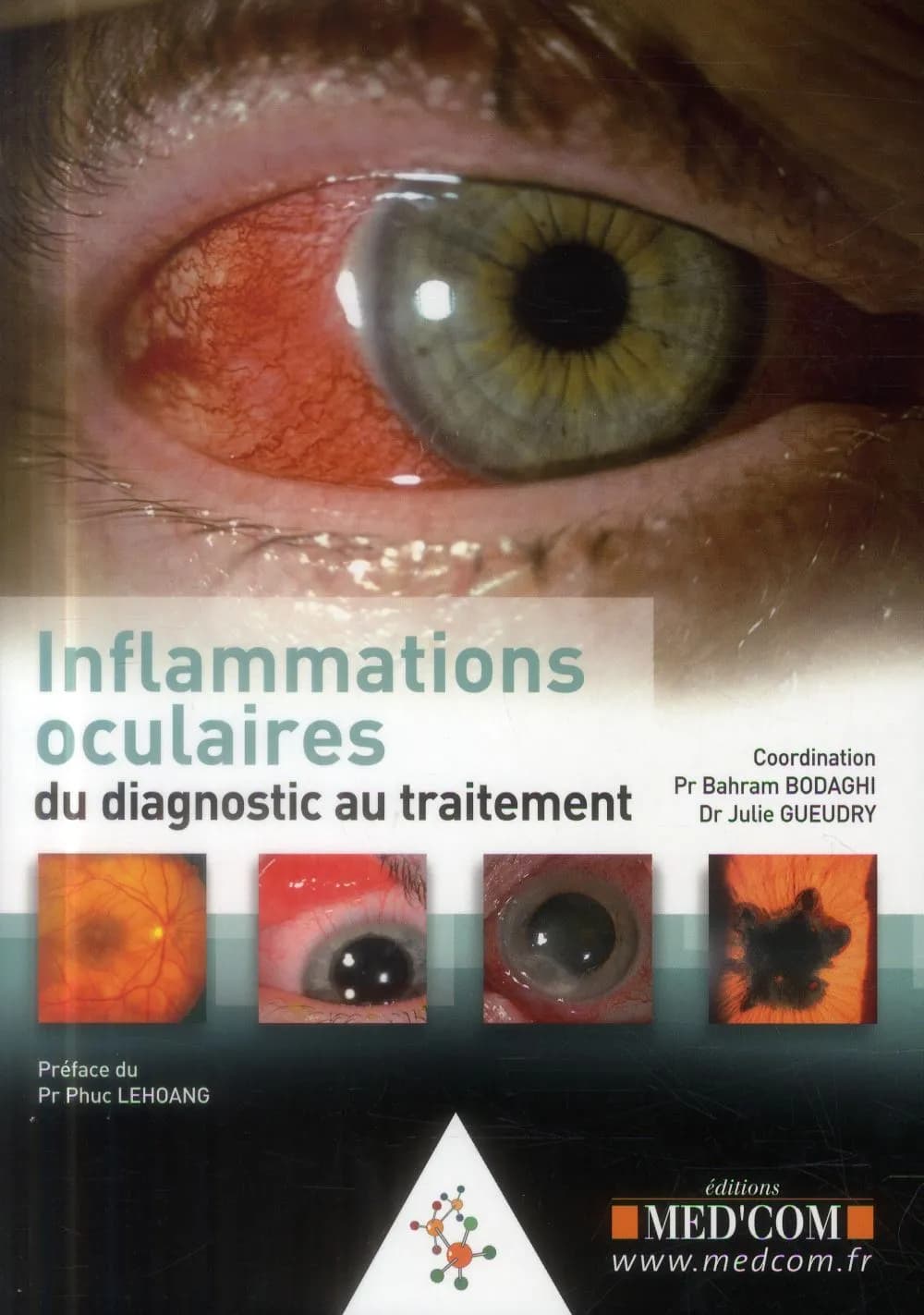 Inflammations oculaires : du diagnostic au traitement