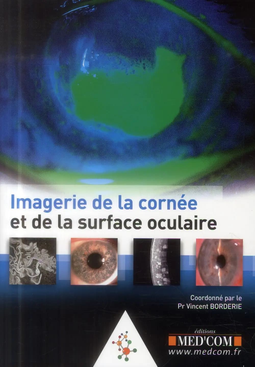 Imagerie de la cornée et de la surface oculaire