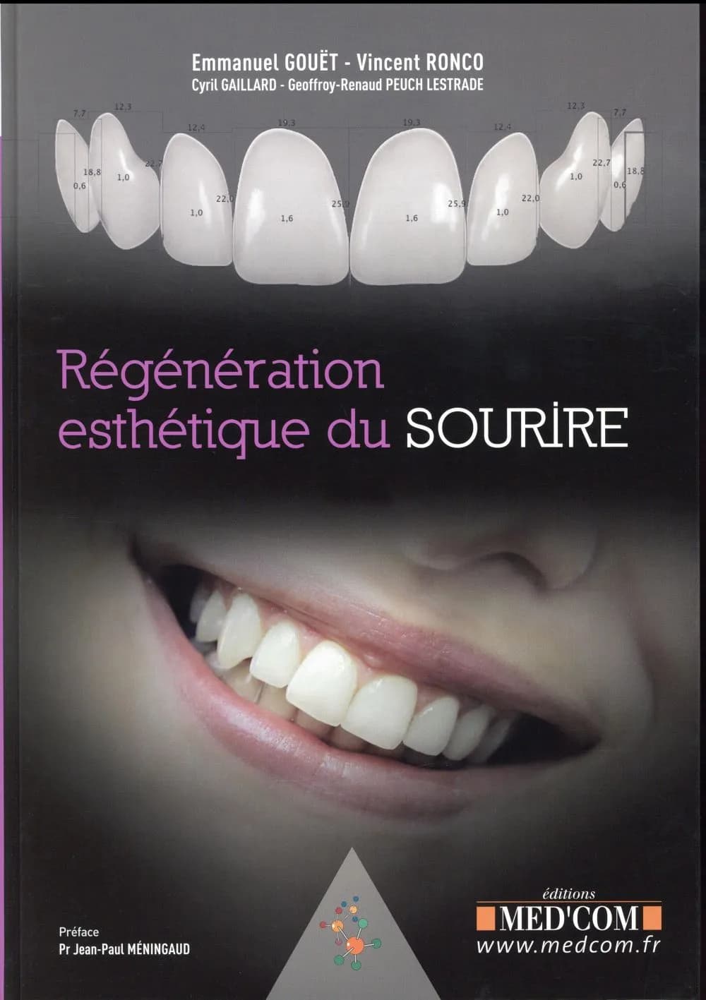Régénération esthétique du sourire