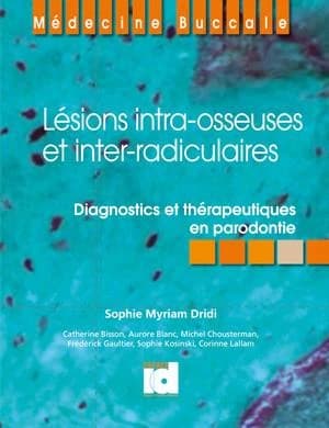 Lésions intra-osseuses et inter-radiculaires : diagnostics et thérapeutiques en parodontie