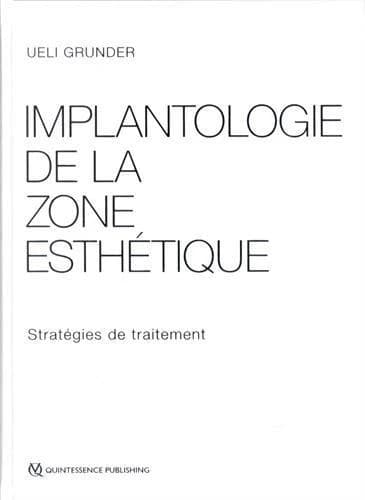 Implantologie de la zone esthétique : stratégies de traitement