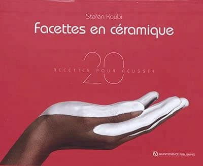 Facettes en céramique : 20 recettes pour réussir