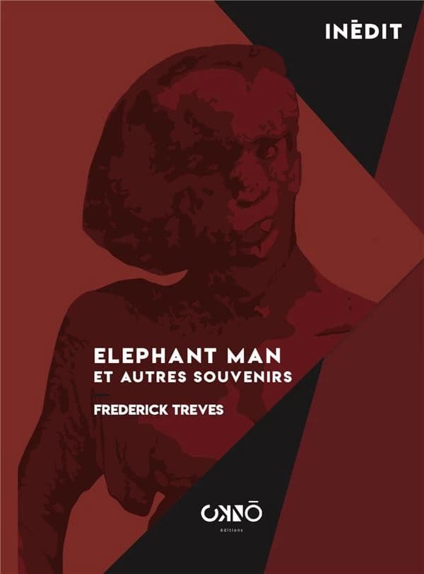 Elephant man et autres souvenirs : 1923
