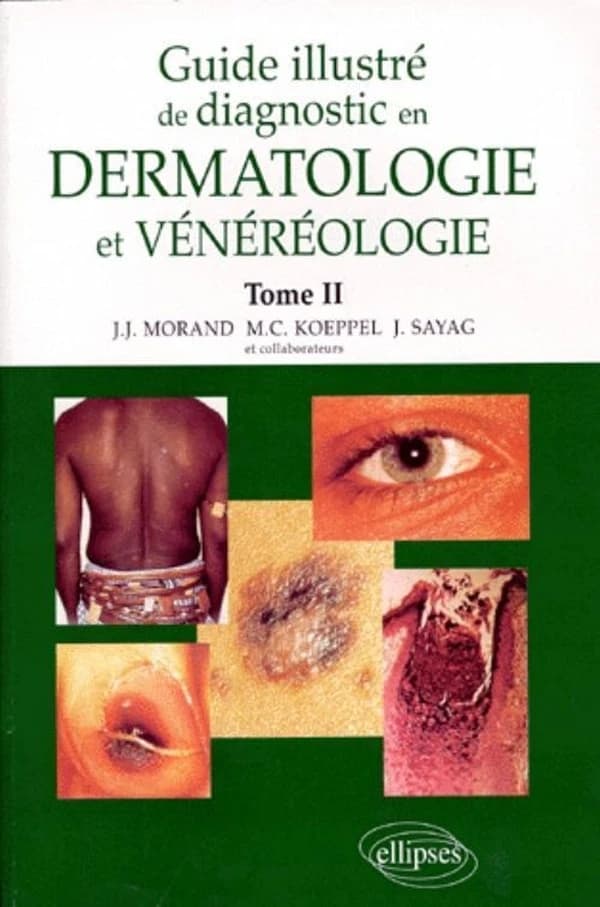 Guide illustré de diagnostic en dermatologie et vénéréologie. Tome 2