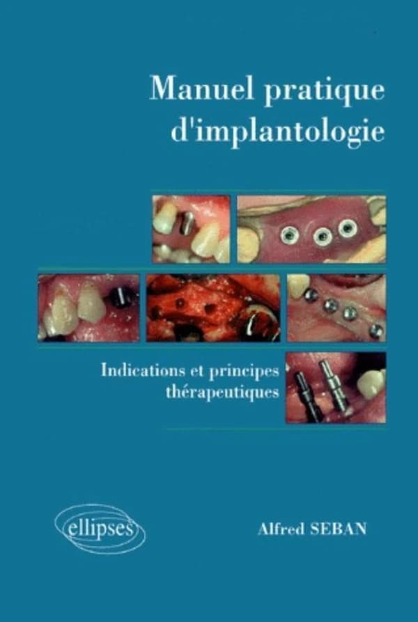 Manuel pratique d'implantologie : indications et principes thérapeutiques