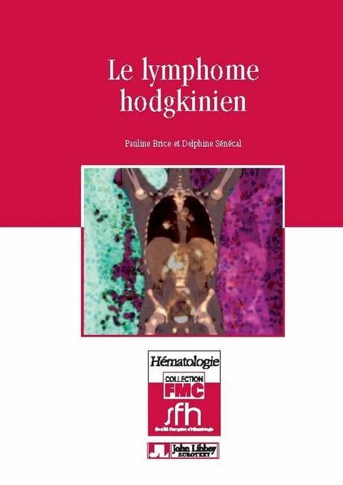 Le lymphome hodgkinien (2e éd.) [sous la direction de] Pauline Brice et Delphine Sénécal