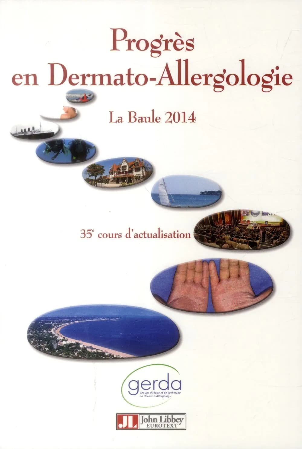 Progrès en dermato-allergologie : La Baule 2014