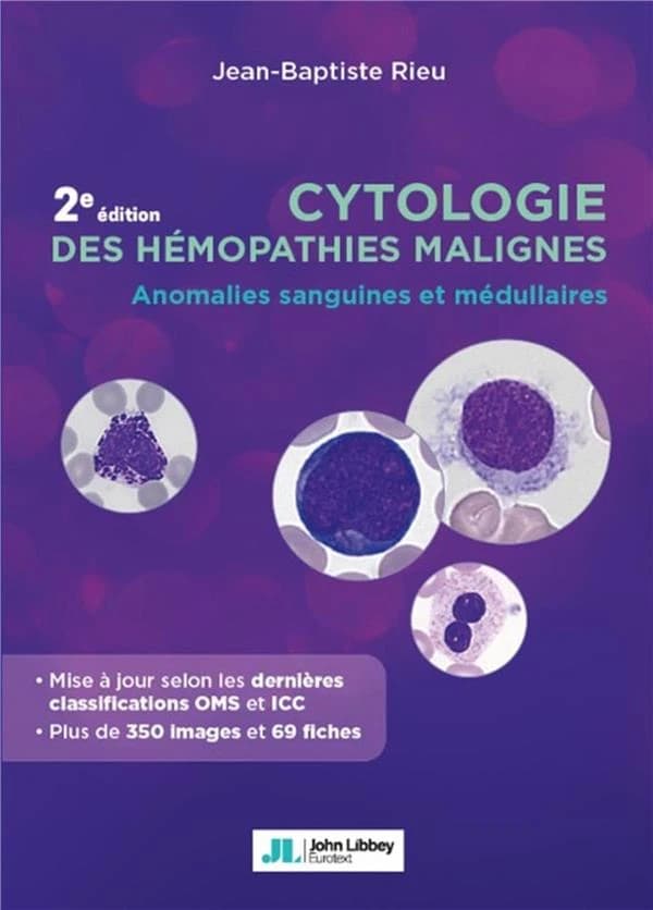 Cytologie des hémopathies malignes : anomalies sanguines et médullaires (2e éd. entièrement actualisée) Jean-Baptiste Rieu