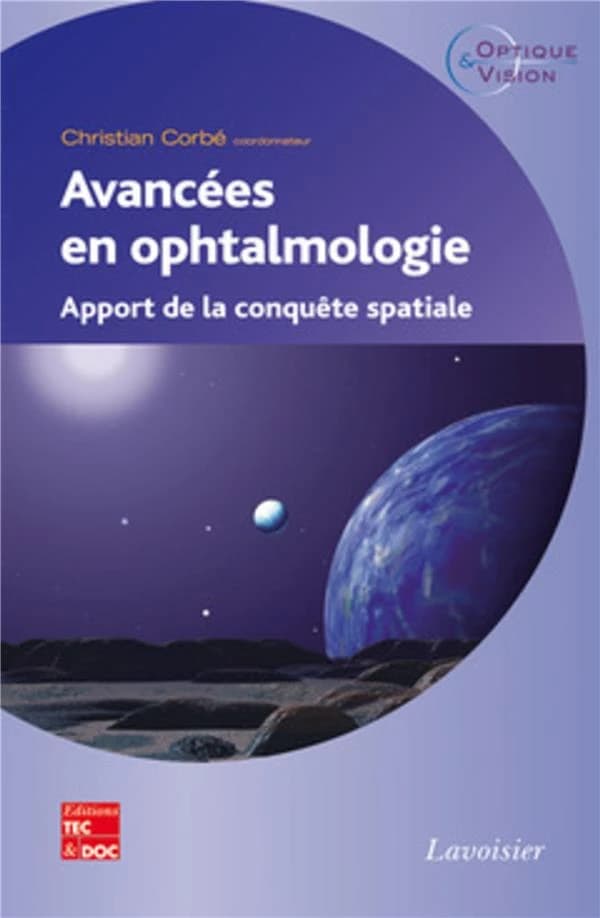 Avancées en ophtalmologie : apport de la conquête spatiale
