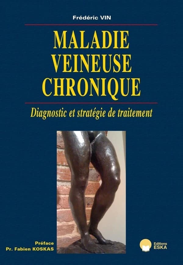 Maladie veineuse chronique : diagnostic et stratégie de traitement