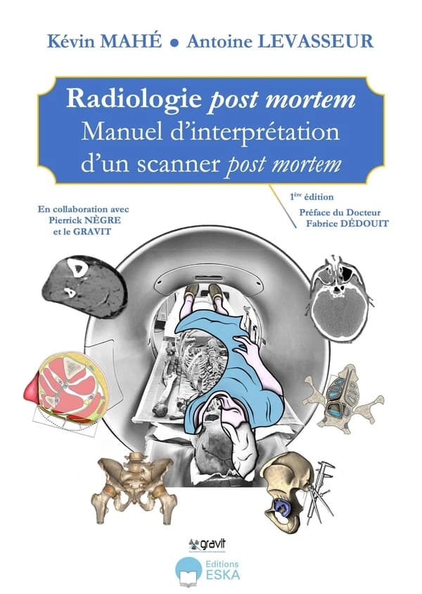 Radiologie post mortem : manuel d'interprétation d'un scanner post mortem