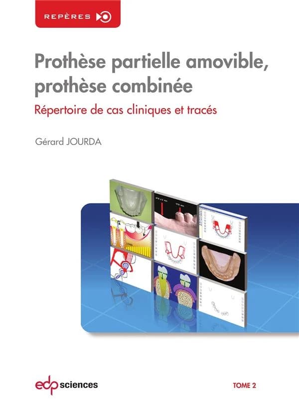 Prothèse partielle amovible, prothèse combinée. 02. Tome 2, Répertoire de cas cliniques et tracés
