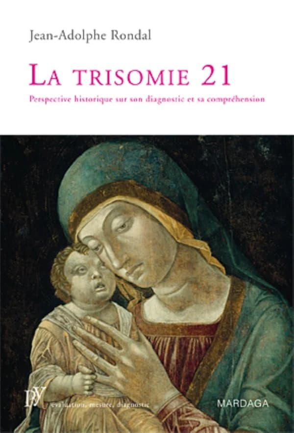 Trisomie 21 ; perspective historique sur son diagnostic et sa compréhension