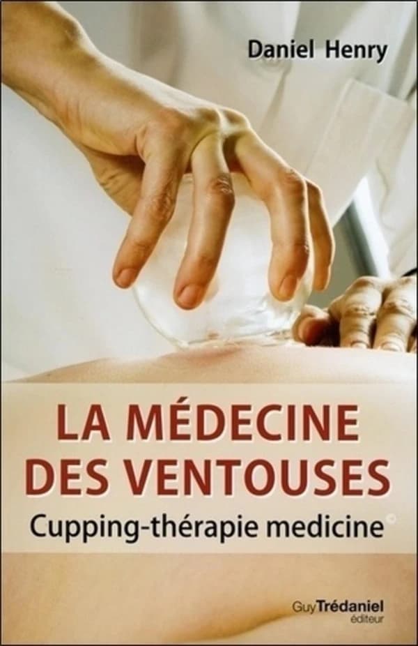 La médecine des ventouses (French Edition)