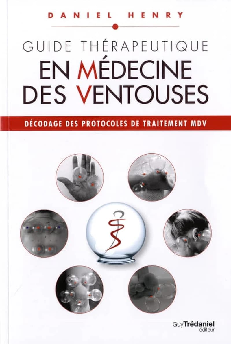 Guide thérapeutique en médecine des ventouses : décodage des protocoles de traitement MDV