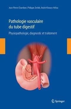 Pathologie vasculaire du tube digestif : physiopathologie, diagnostic et traitement
