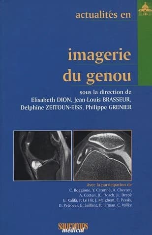 Actualités en imagerie du genou