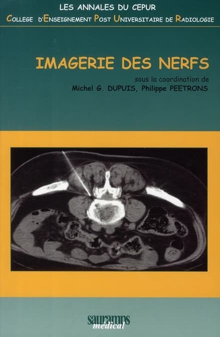 Imagerie des nerfs