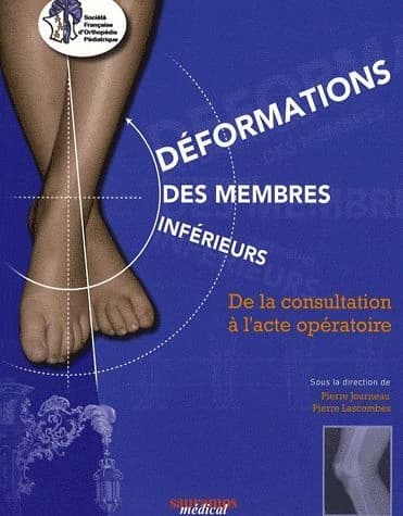 Les déformations des membres inférieurs : de la consultation à l'acte opératoire