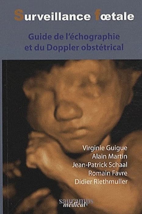 Surveillance foetale : guide de l'échographie et du Doppler obstétrical
