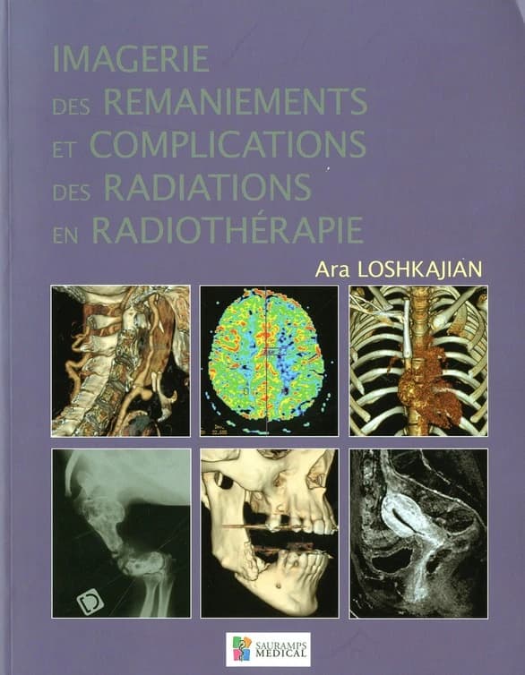 Imagerie des remaniements et complications des radiations en radiothérapie