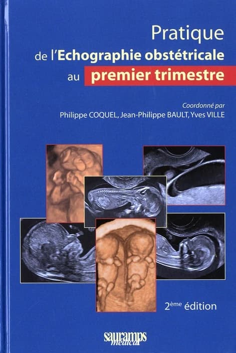 Pratique de l'échographie obstétricale au 1er trimestre (2e éd.) coordonné par Philippe Coquel, Jean-Philippe Bault, Yves Ville ; avec la participation de Yves Ardaens, Jean-Philippe Bault, Jean-Pierre Bernard... [et al.]