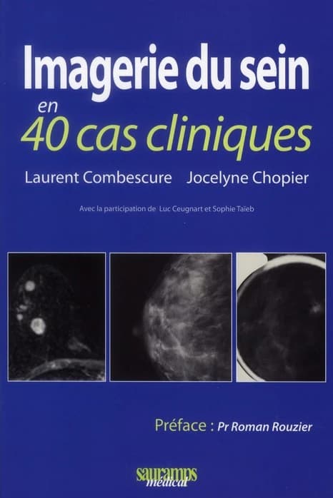 Imagerie du sein : en 40 cas cliniques